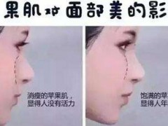 “苹果肌”能让人看起来年轻10岁？怎么才能拥有？