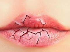 冬季如何保持嘴唇湿润、淡化唇纹？