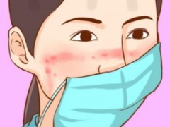 口罩容易闷痘？如何解决？