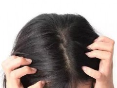 头皮里总是长痘痘，又疼又痒，该怎么办？