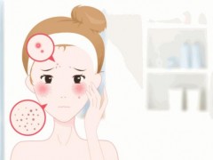 夏季脸部爱出油怎么办？这些控油小技巧快来看！
