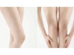 永久拖腿毛后需注意什么？