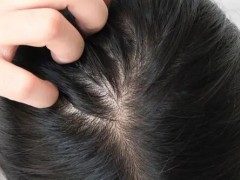 头皮清洁太重要了，快来看看！