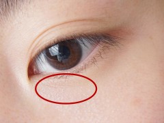 眼周有小细纹怎么办？
