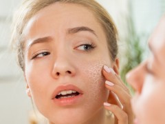 秋季换季敏感肌该怎么办？