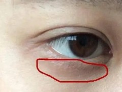 双十一付尾款熬的夜，要拿什么更好地消除黑眼圈？