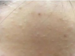 有“闭口”的女生，看过来