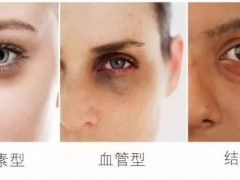 黑眼圈很重从这几点做起！