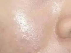 脸上爱出油怎么办？