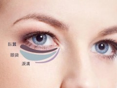 消除眼袋小妙招