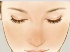 “脸太油”怎么办？