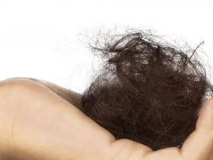 脱发严重是什么原因引起的？