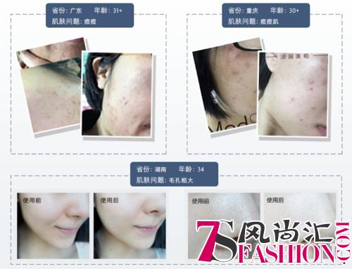 敏感肌可用的洁面 法国美帕蓝球洁面晶露囤起来！