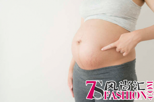 妊娠纹重在预防！日本孕妈们爱用的人气身体护肤品了解一下？