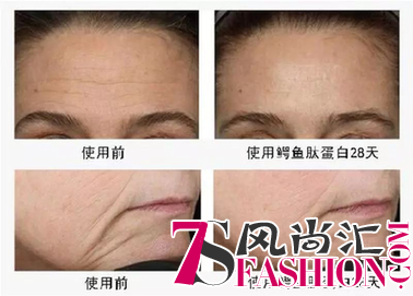 抗衰老，从卡蓓丝护肤，鳄鱼C-3A精华面膜开始！