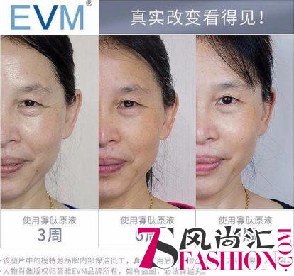 EVM 新时代复配型肌肤管理