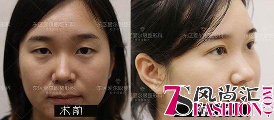 打造更美自己：成都东区爱尔眼整形4S新标准发布会暨年度盛典
