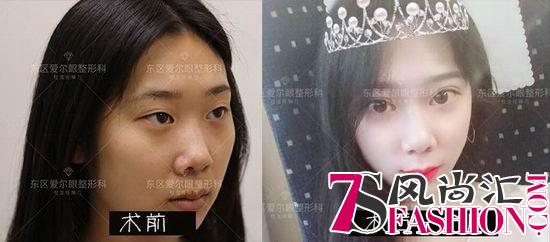 打造更美自己：成都东区爱尔眼整形4S新标准发布会暨年度盛典