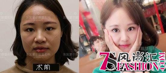 打造更美自己：成都东区爱尔眼整形4S新标准发布会暨年度盛典