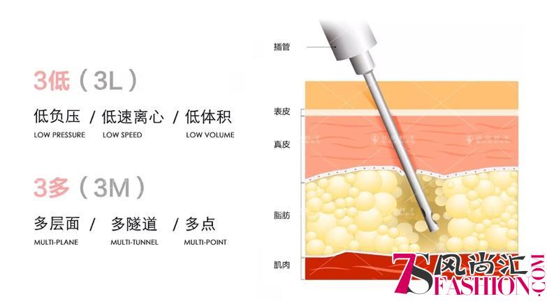 北京叶子杨峰携手韩国脂肪大师姜景进教授 全面升级面部填充技术