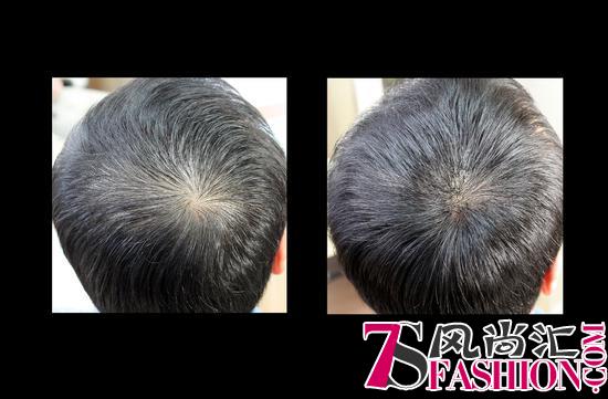 爱德兰丝自然增发 拯救型男魅力