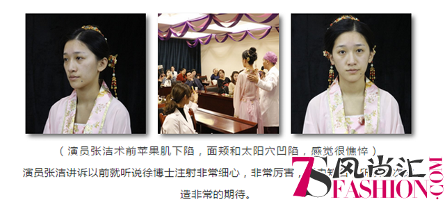 张洁术前.png