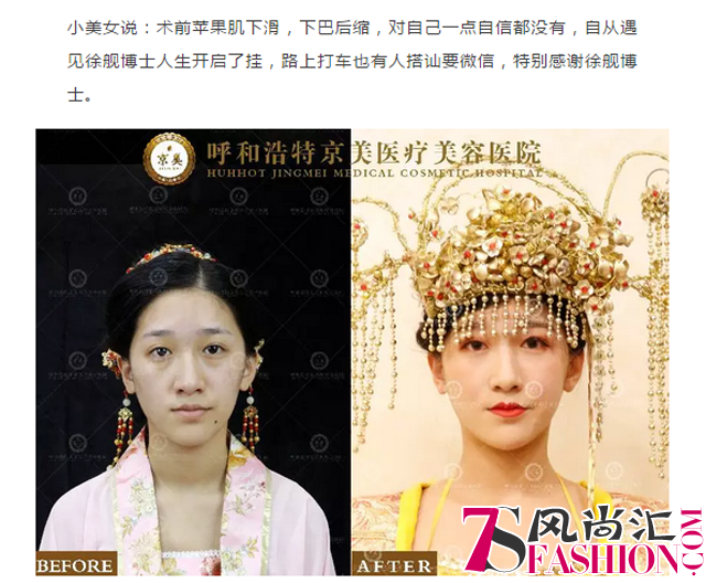 对比照1.png