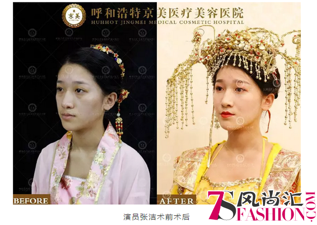 对比照2.png