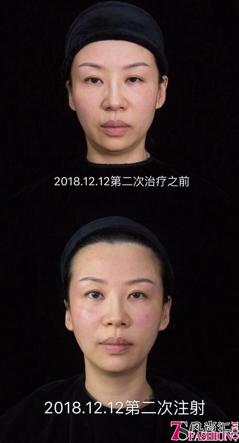 全球打造“乔女郎”：中国医美博士黄高敏技压群芳，获美国专家点赞
