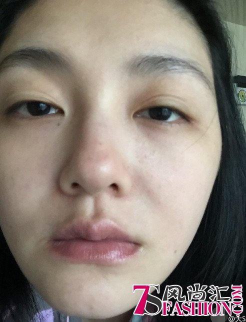 大S罕见晒面部纯素颜特写，可是脖子上怎么了？ 