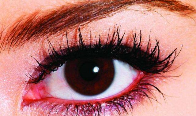 眼睛发炎充血的原因 如何让我们早日预防远离它
