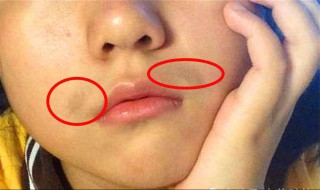 女生长胡子解决办法 两个方法就可以搞定