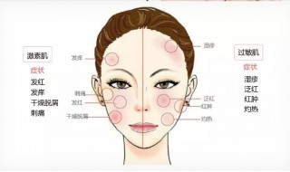 激素脸好了以后用什么样的护肤品油性皮肤 激素脸可以用什么护肤品?
